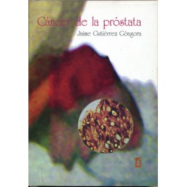 CANCER DE LA PROSTATA (VERSION IMPRESA)